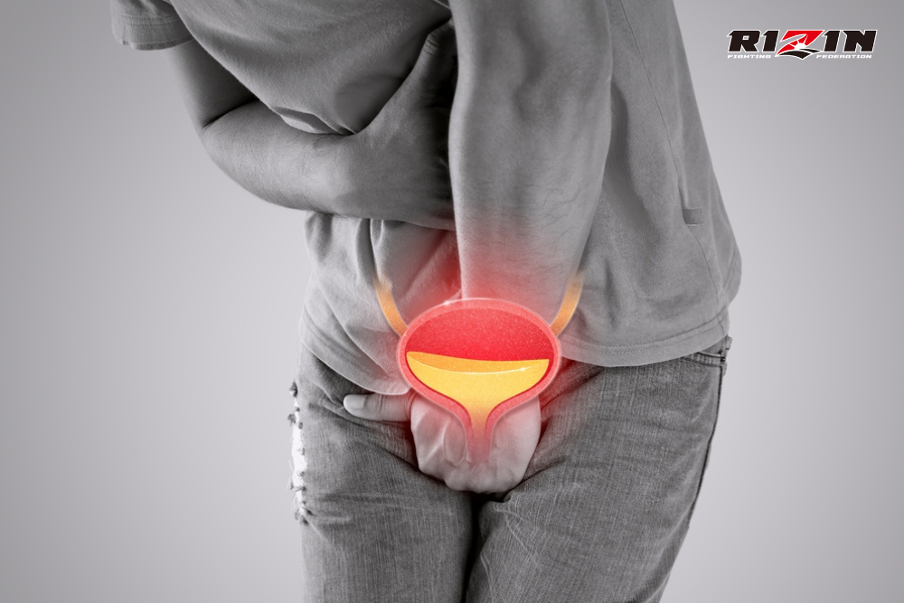 Sỏi Bàng Quang Là Gì? Nhận Biết Nguyên Nhân Và Triệu Chứng
