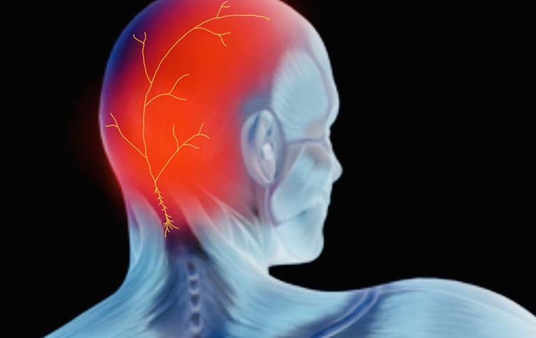 Ảnh hưởng hệ thần kinh